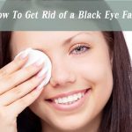 how to get rid of a black eye