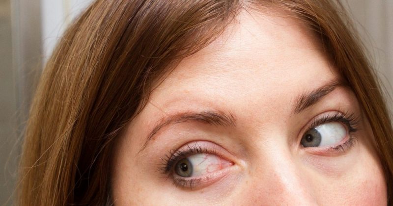 How to get rid of red eyes fast