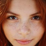 Home Remedies to Get Rid Of Freckles