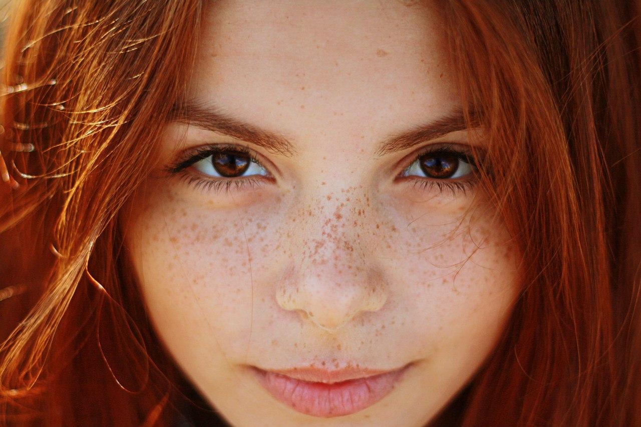 Home Remedies To Get Rid Of Freckles.