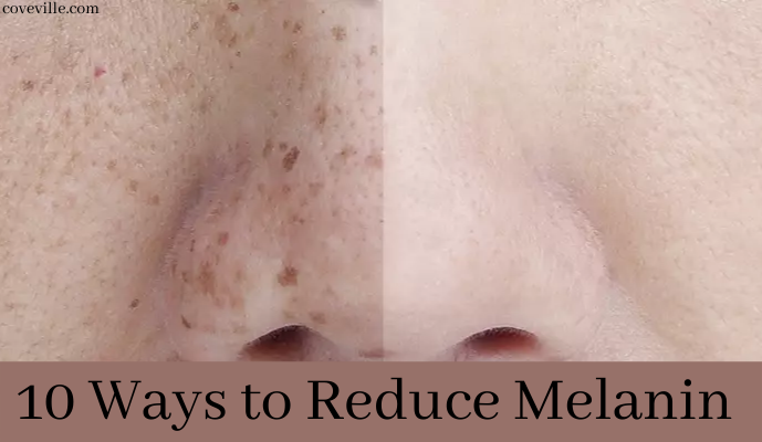 Get Fairer Skin Tone – 10 Ways to Reduce Melanin