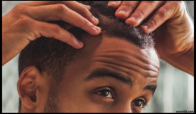 What Does It Take to Fix Dry Scalp Naturally