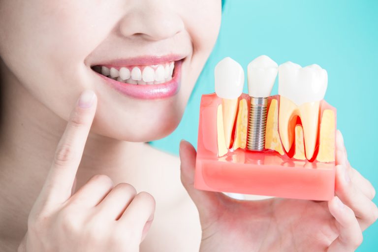 what does a dental implant cost