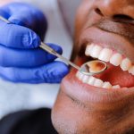 how does a dentist fix a cracked tooth
